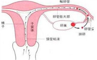 輸卵管堵塞的癥狀有哪些？
